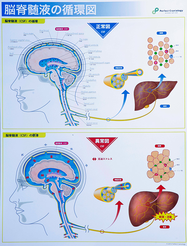 ポスター 脳脊髄液調整法 パーフェクトクラニオロジー協会